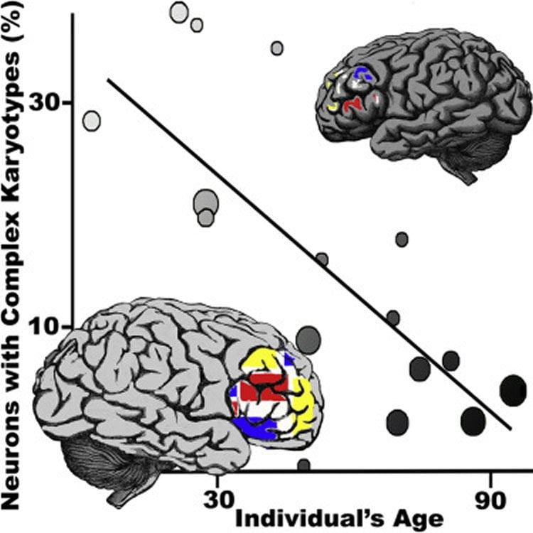 frontal lobe