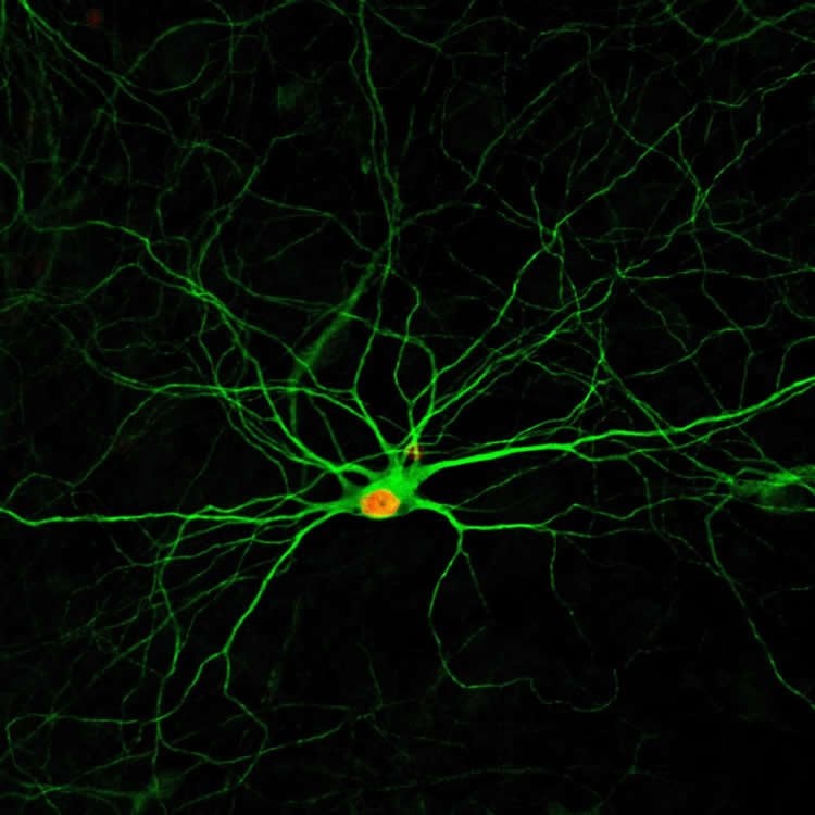 a neuron