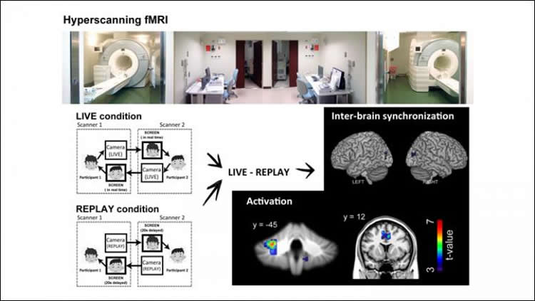 brain scans