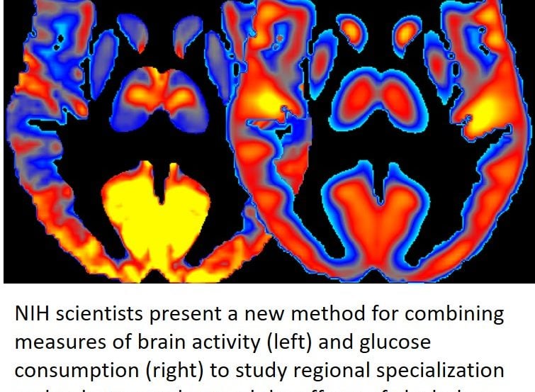 Two brightly colored brain images are shown side by side.