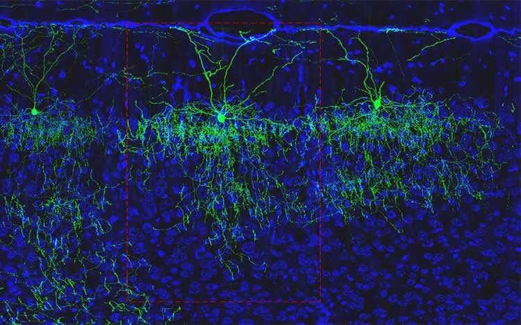 AAC cells in the mouse cortex