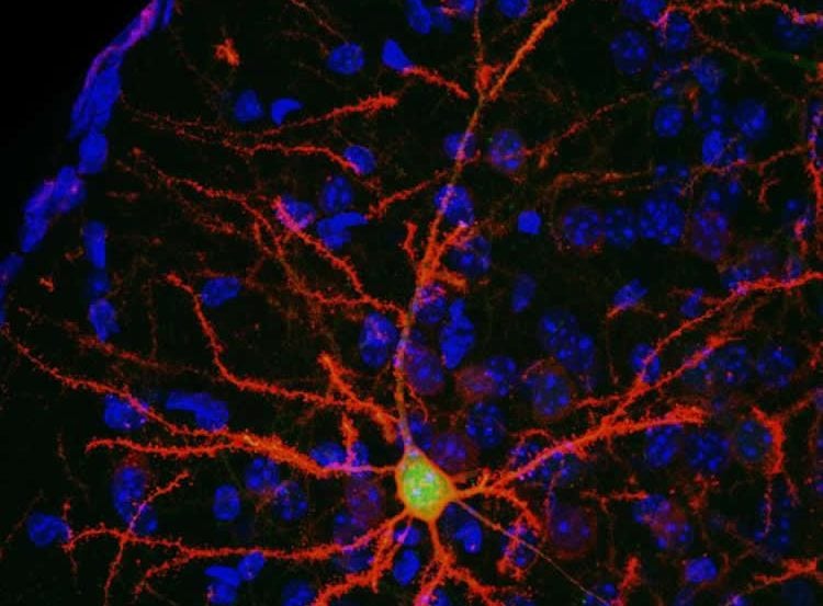 neurons are shown in this image