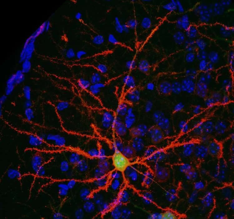 neurons are shown in this image