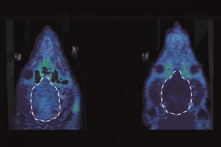 kappa opioid receptors are shown