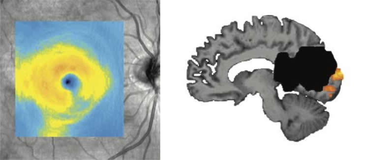 the visual cortex is shown