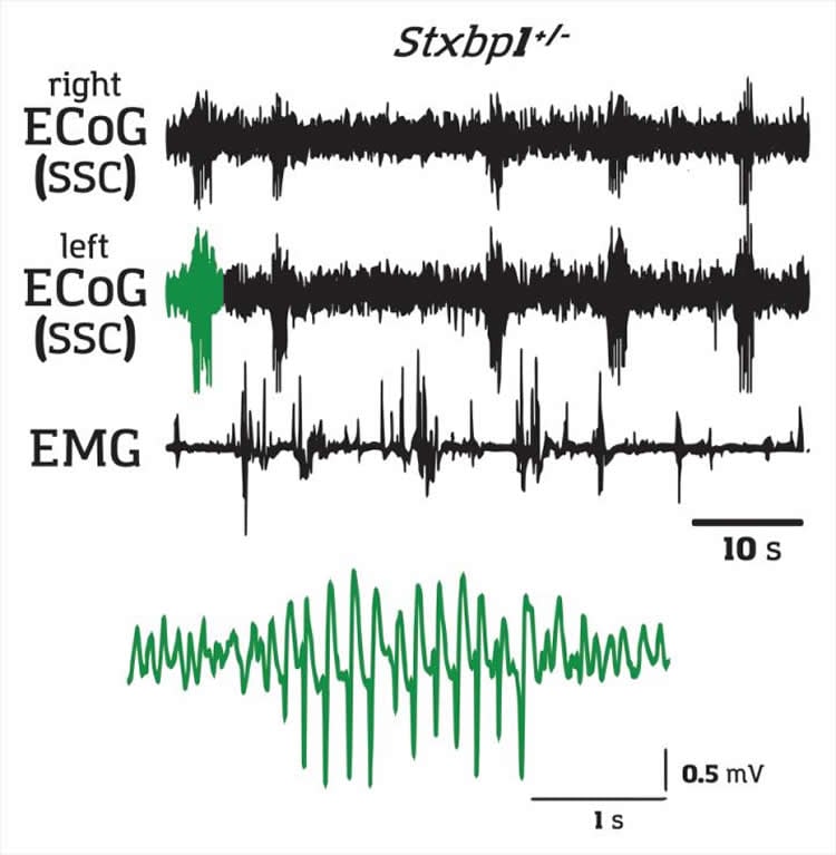 This shows the EEG readout