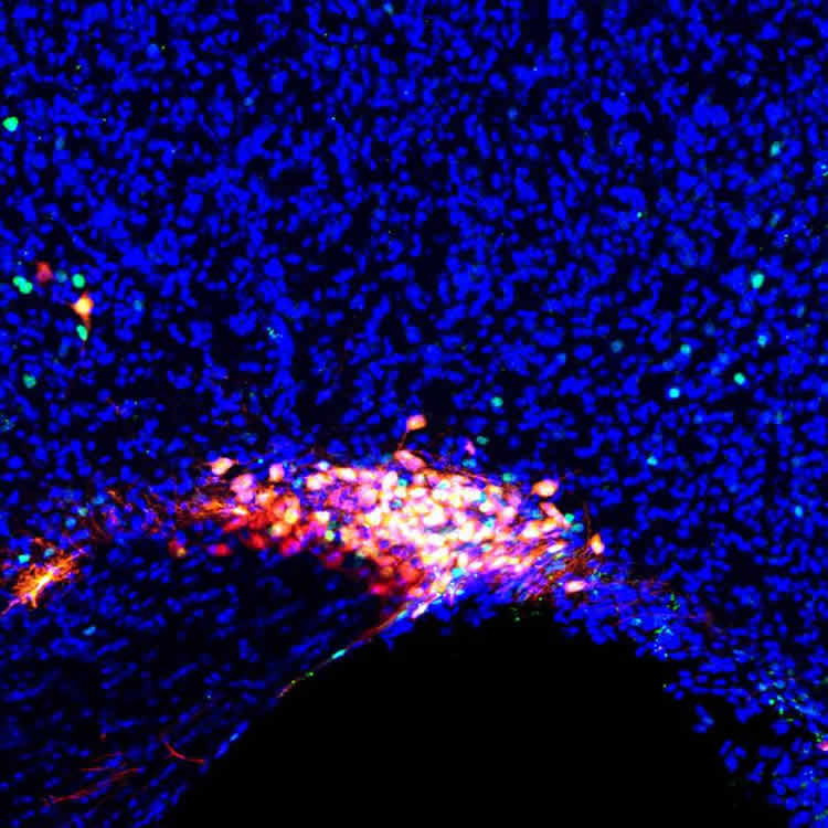 This shows AAN activation in the supraoptic nucleus