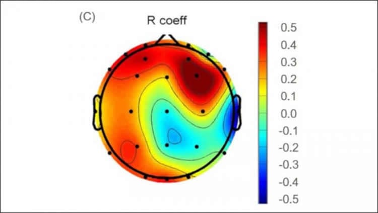 This shows an EEG readout from the study