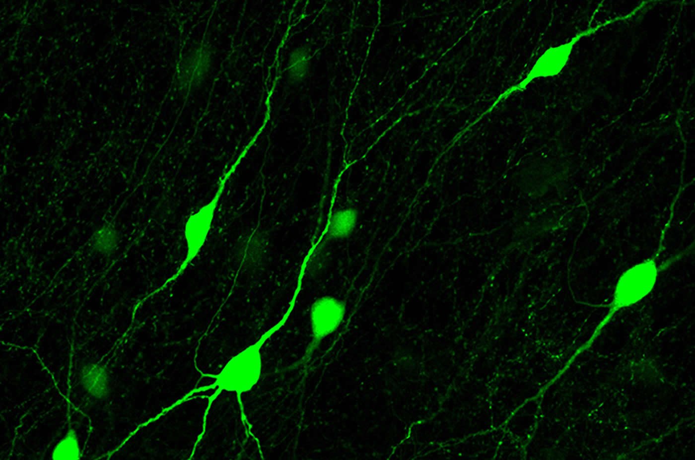 This image shows green neurons