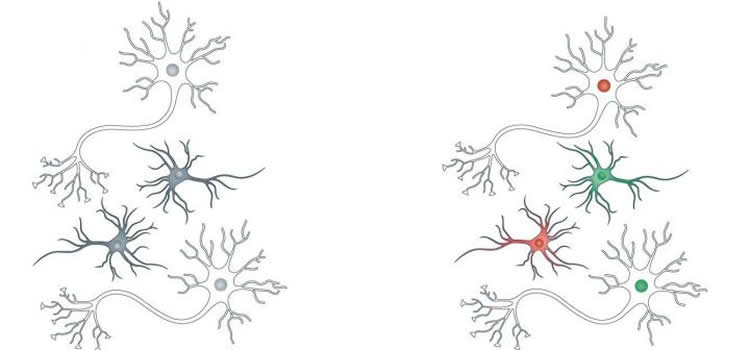 This shows a drawing of neurons
