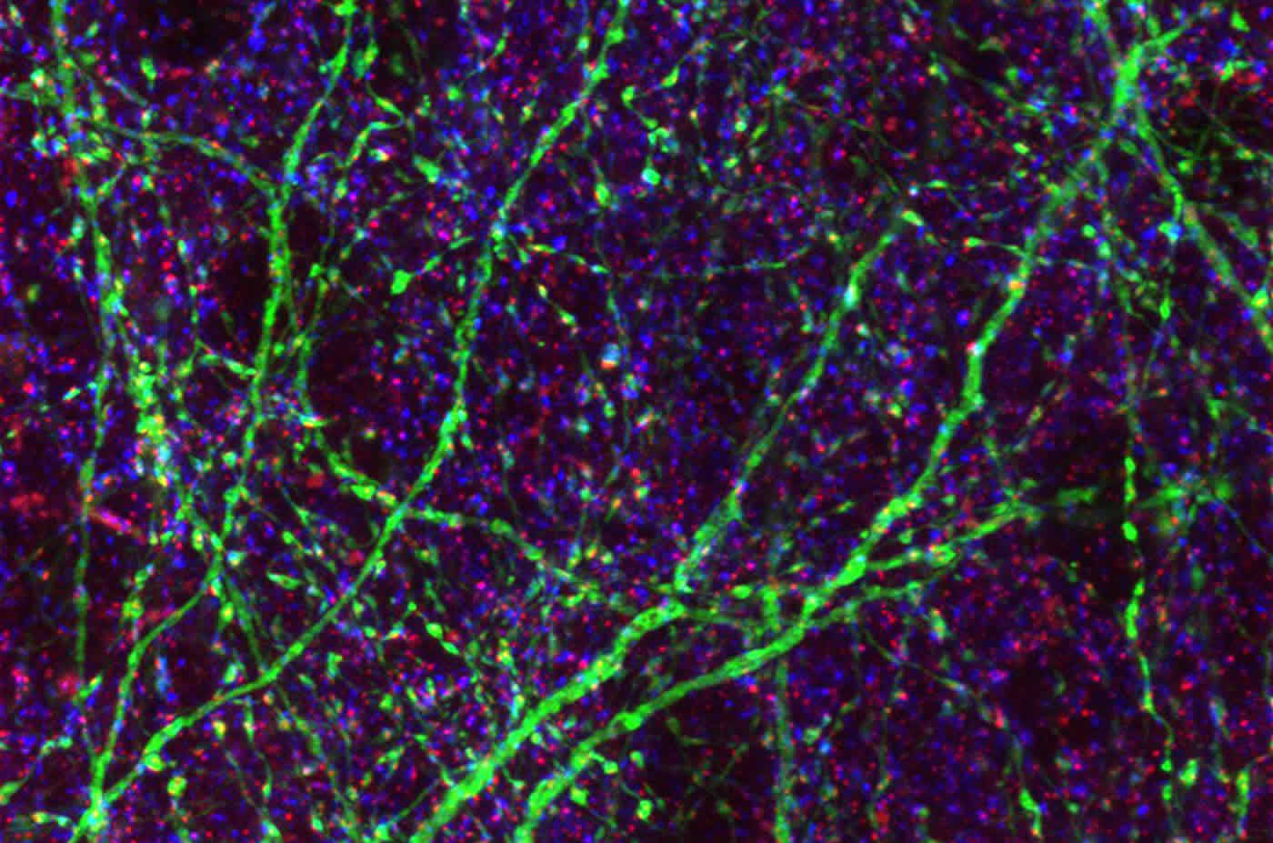 This shows neurons and synapses in purple and green
