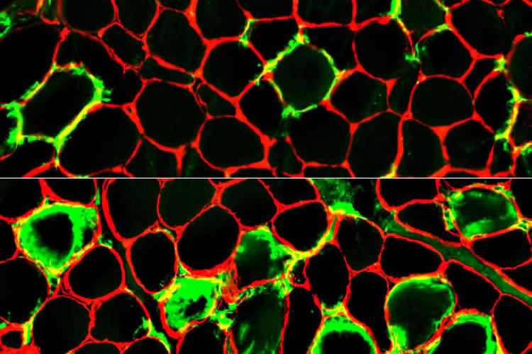 This shows immune scavenger cells