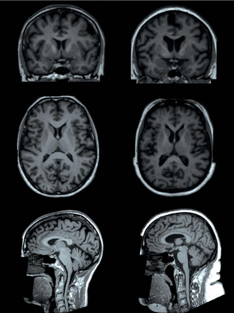 This shows brain scans from the study