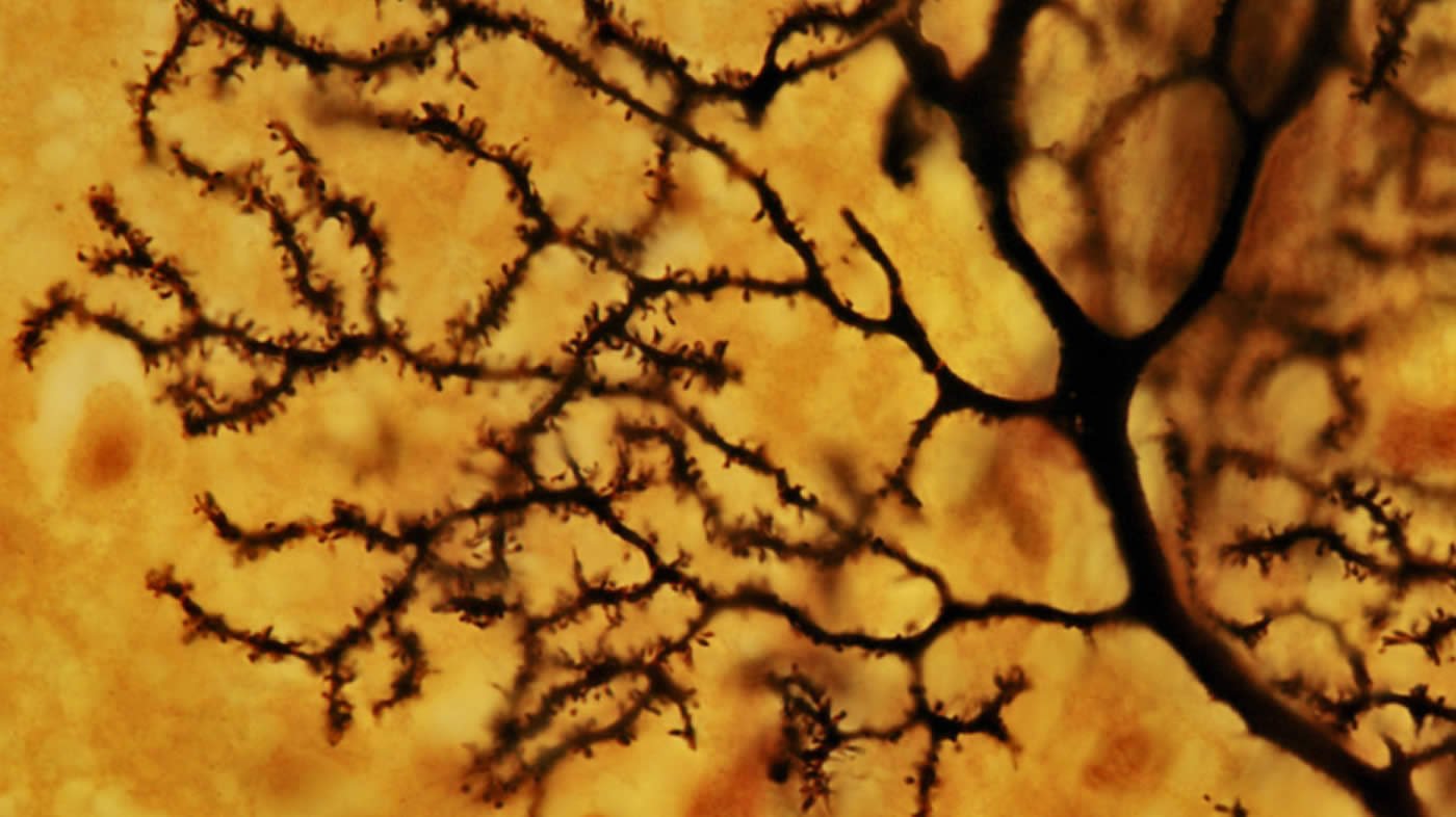 This image shows purkinje cells in the cerebellum