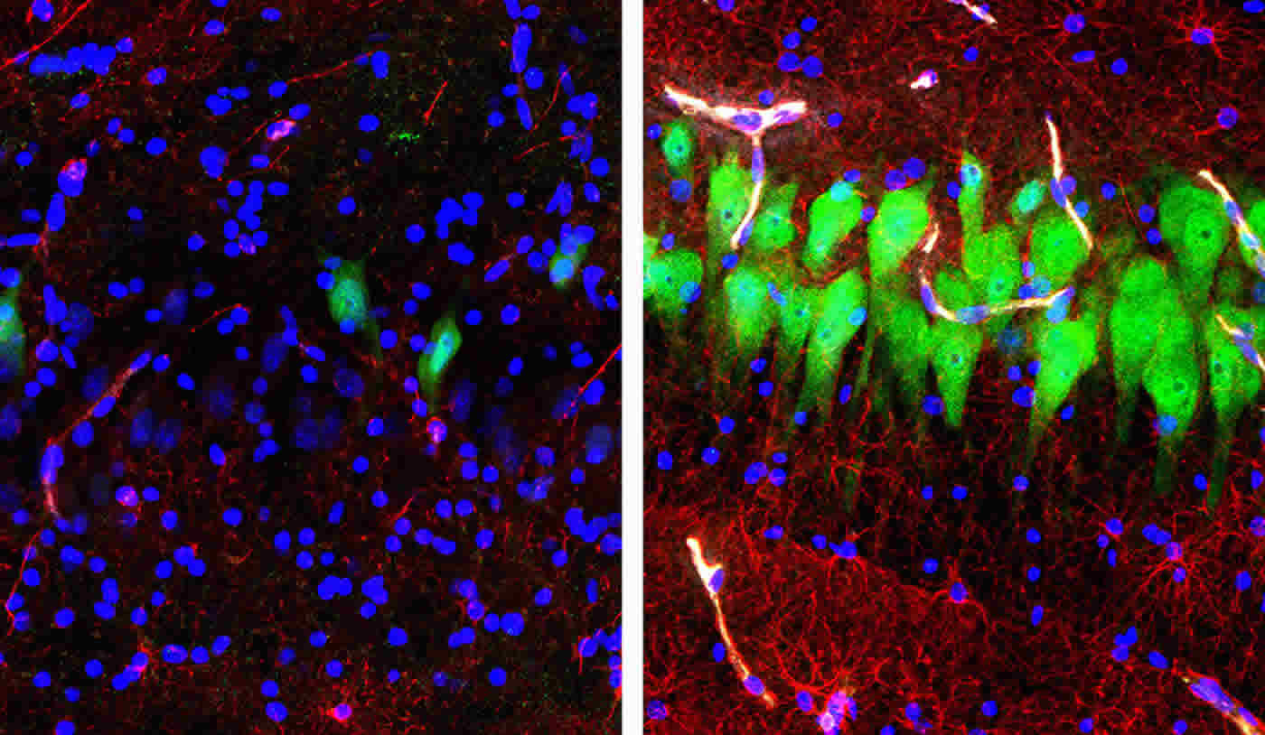 This shows neurons and astrocytes before and after reanimation