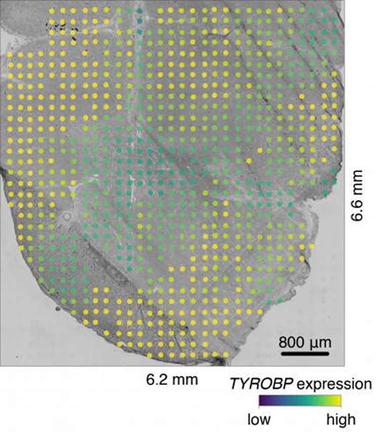 This shows tyrobp expression in cells from the spinal cord in ALS