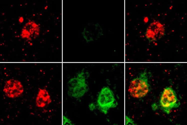 oligodendrocytes from alzheimer's brain tissue are shown