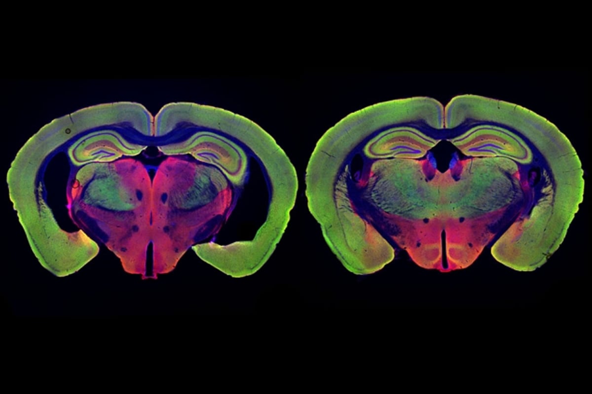 This shows brain slices from a mouse