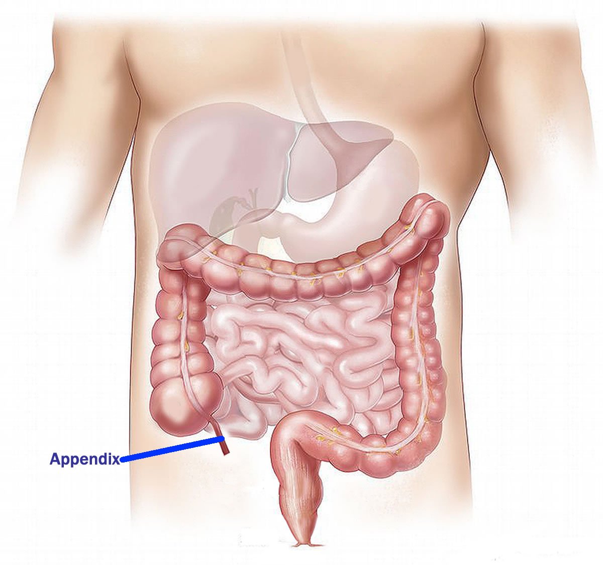 This is a diagram of the intestinal tract with the appendix labeled
