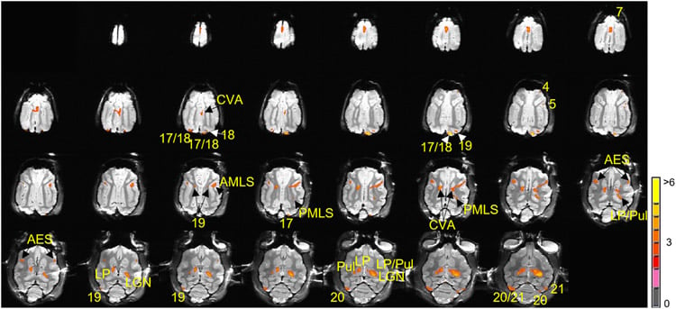 This shows the brain at different stages of brain mapping