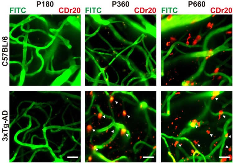 This shows the labeling of microglia