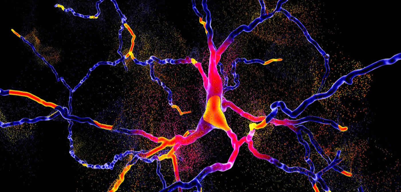 This shows bright pink neurons