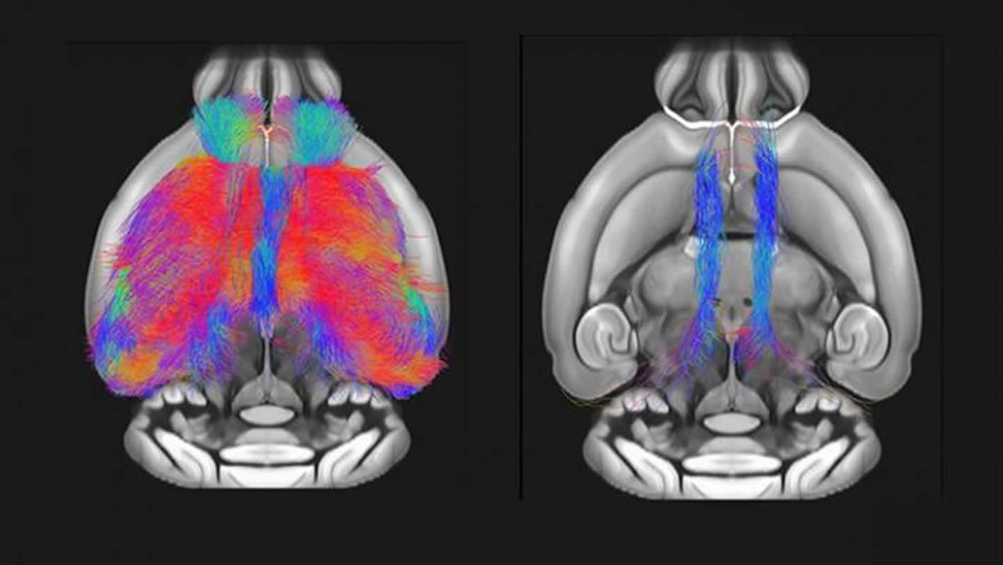 These are fmri scans of the female mice brains lacking shank3
