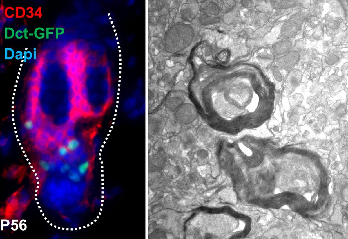 This shows the myelin sheath