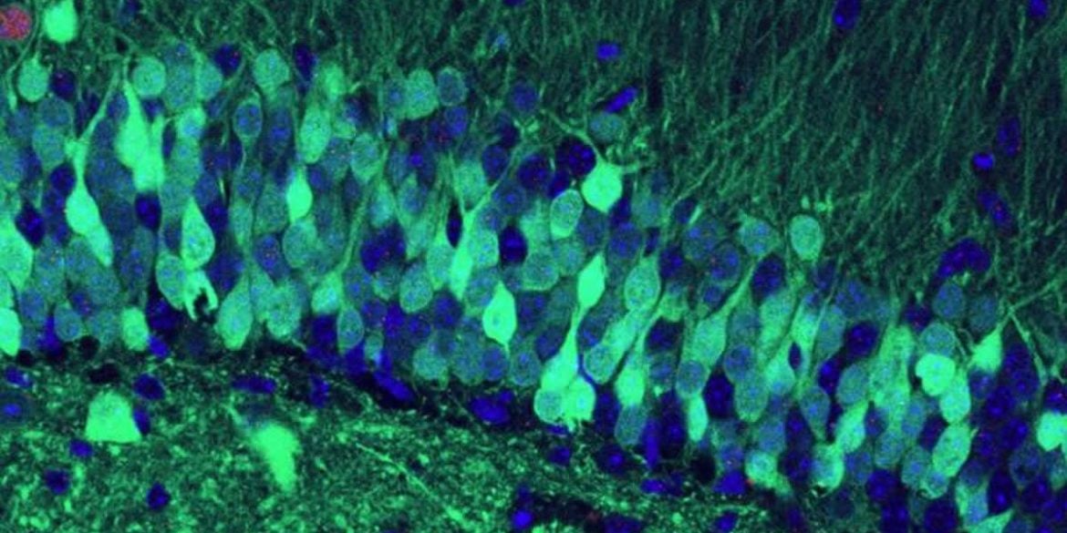 This shows hippocampal cells
