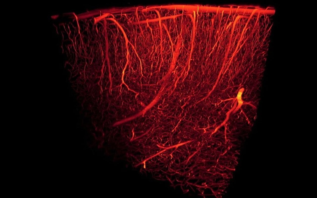 This shows blood vessels