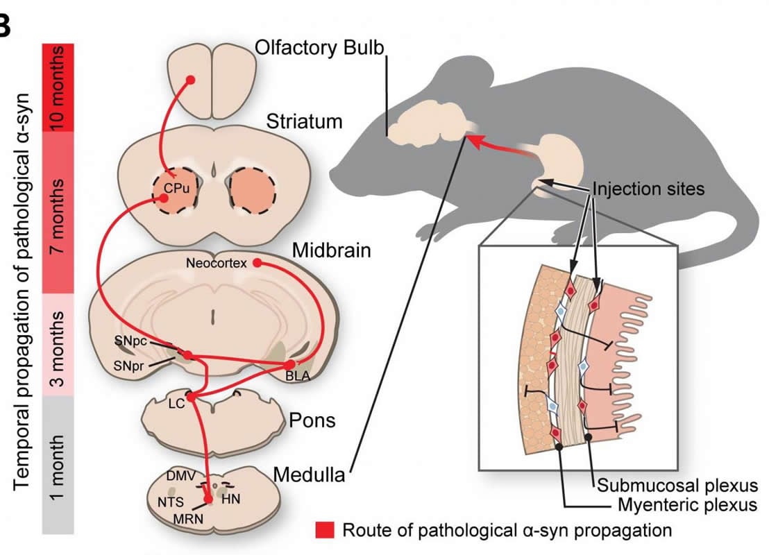 This diagram shows how a-synuclein travels from the gut to the brain via the vagus nerve