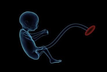 This is a drawing of a fetus attached to a placenta