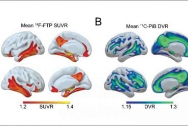 This shows brain scans of the hippocampus during sleep
