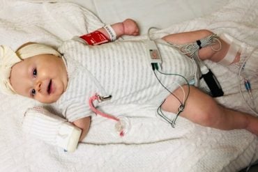 This shows baby Arabella Smygov following gene therapy treatment for SMA