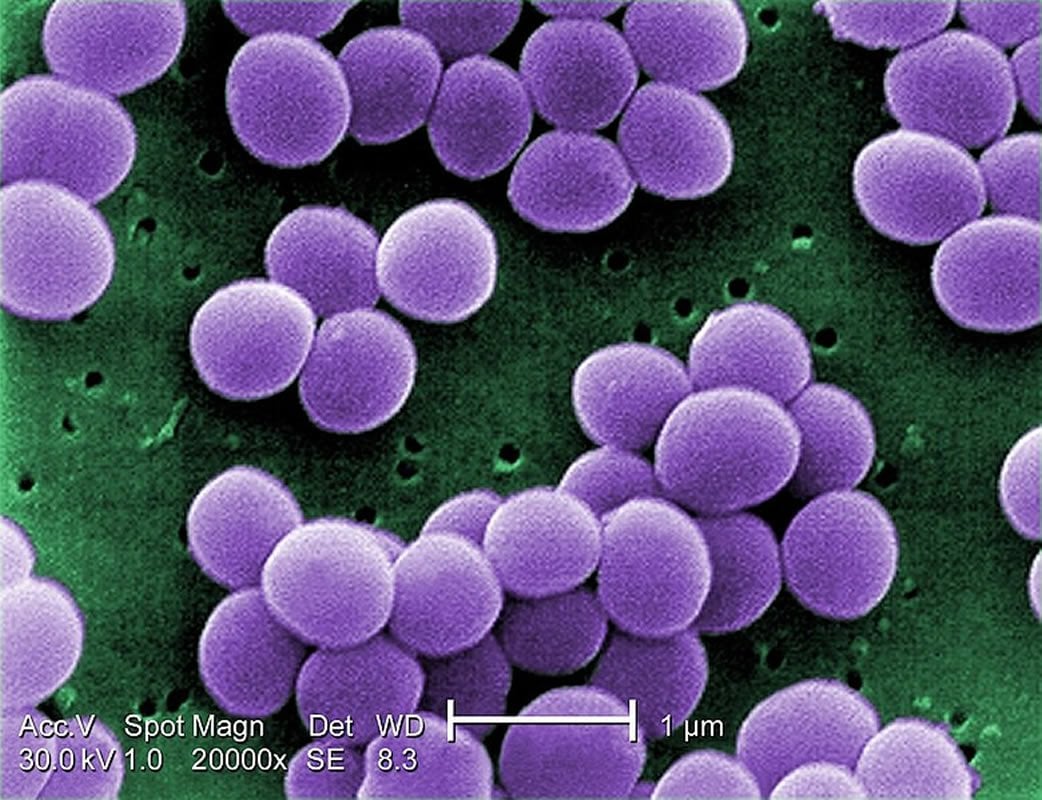 This shows staph bacteria