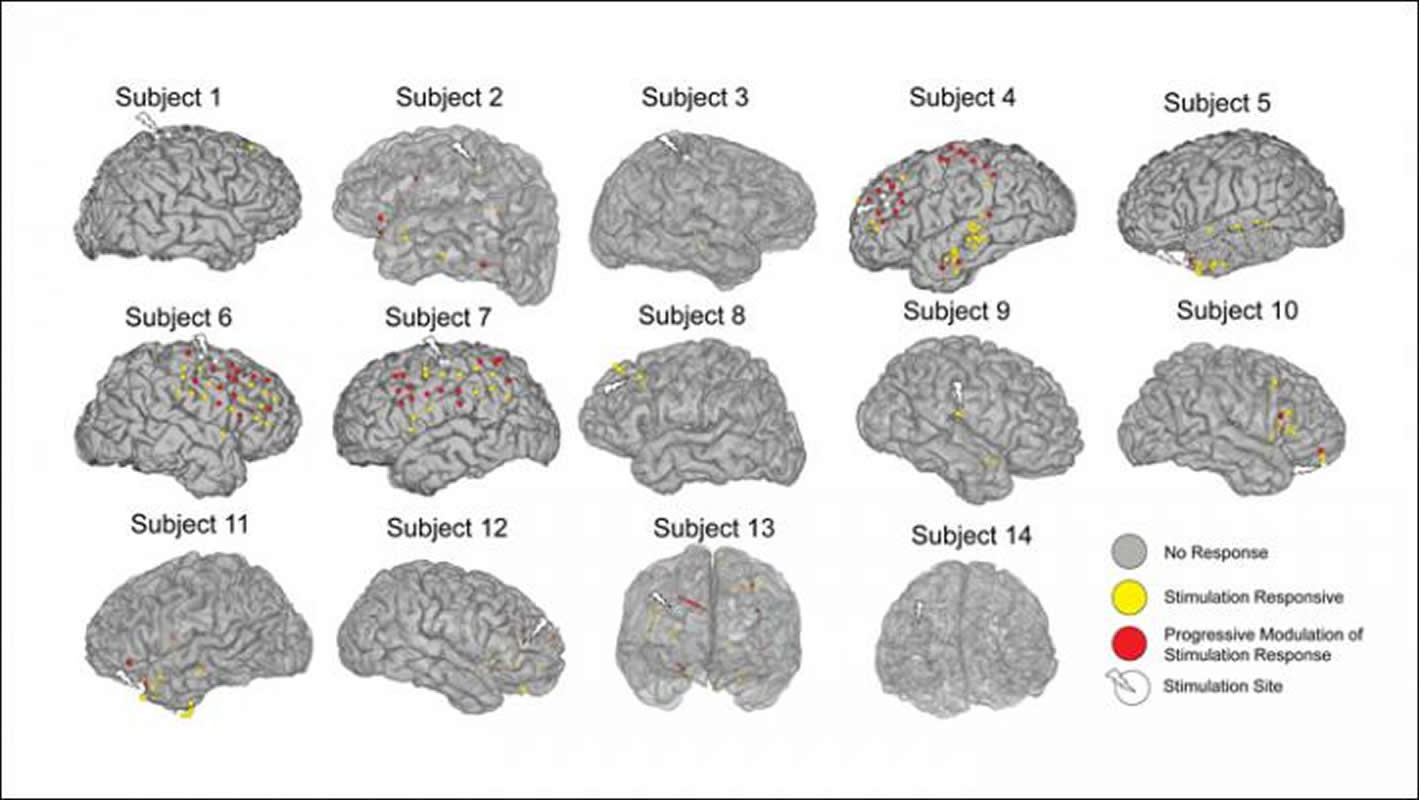 Al brain. Brain Connectivity. Types of Neuroplasticity.