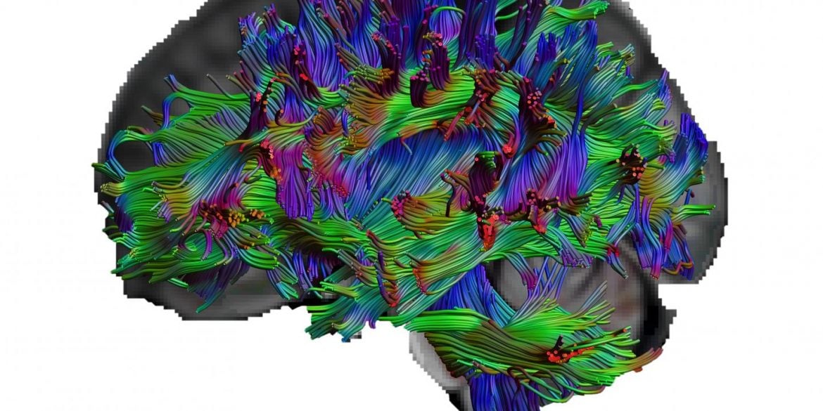 This shows a brain map
