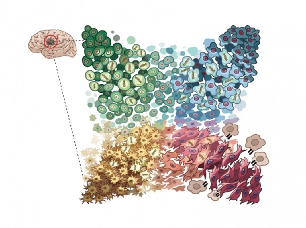 This shows diversity in GBM cells