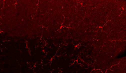This shows microglia activation in the cerebellum