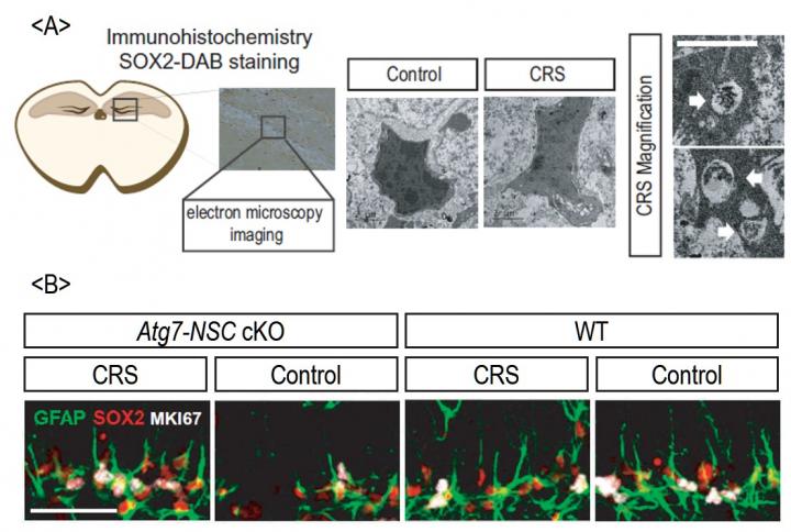 This shows hippocampal cells