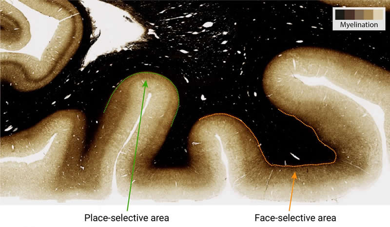 This is a brain slice scan from the study