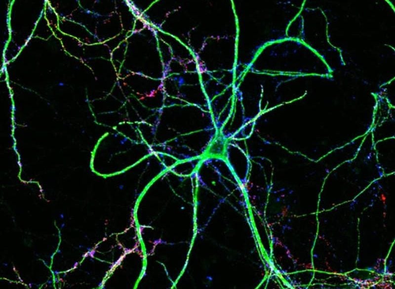 This shows hippocmapal neurons