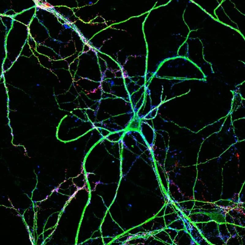 Science link. Митохондрия конфокальная микроскопия. Конфокальная микроскопия нейронов. Нейроны мозга под микроскопом. Нервные клетки под микроскопом.