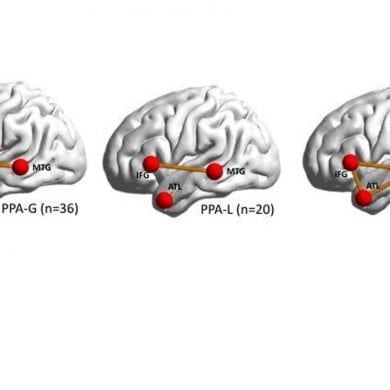 This shows the location of the brain networks