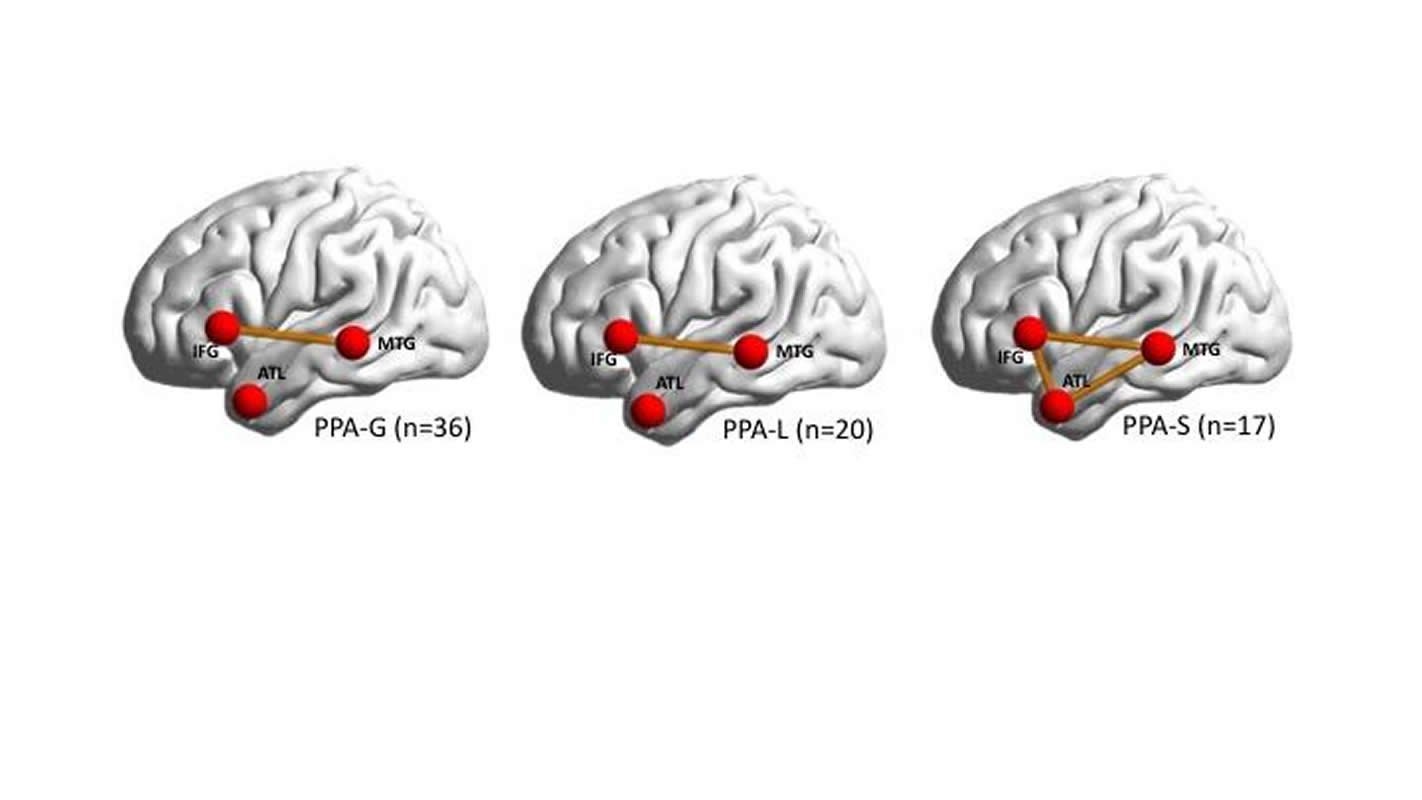 This shows the location of the brain networks