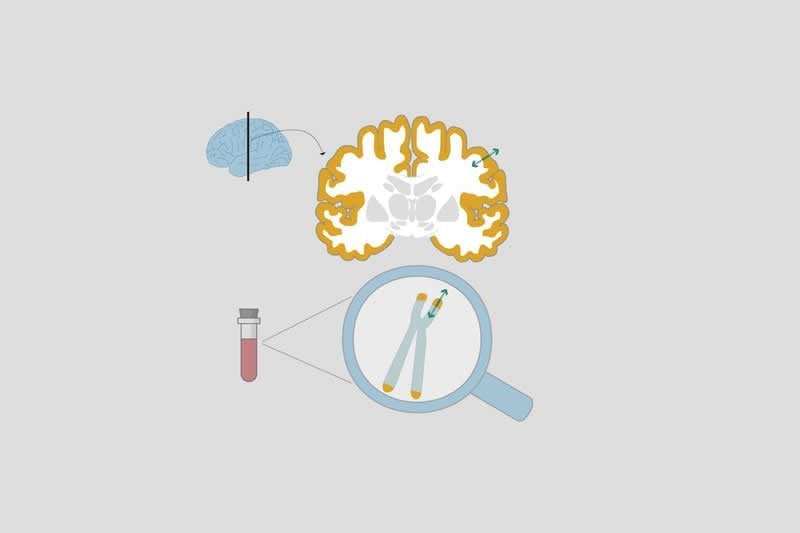 This shows a drawing of a telomere and brain