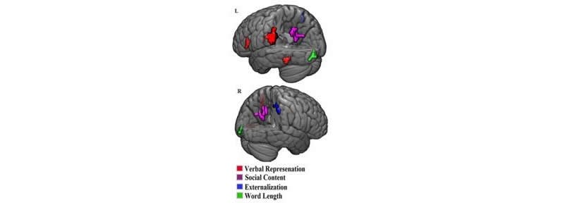 This shows the brain scans