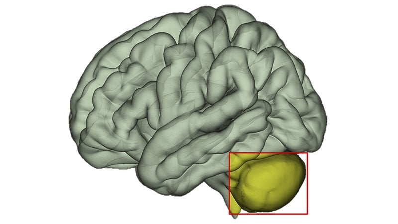 This shows a brain with the cerebellum highlighted