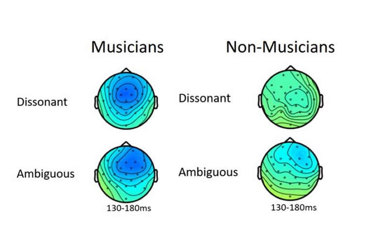 This shows an EEG read out