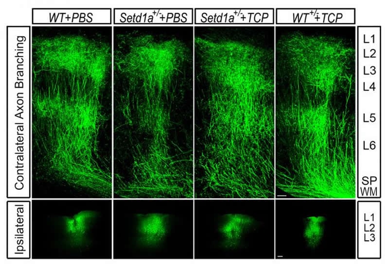 This shows axons and neurons